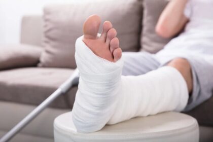 دو ماده استخوان های شکسته را زودتر ترمیم می کنند